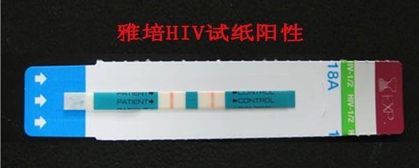 艾滋病试纸检测结果阳性