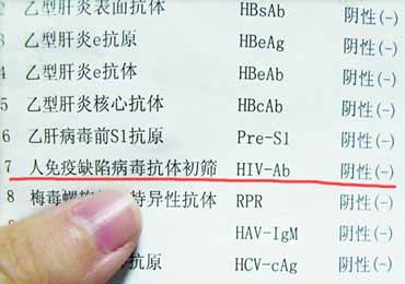 HIV阴性是什么意思