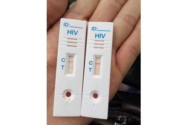 hiv试纸两条杠图片图片