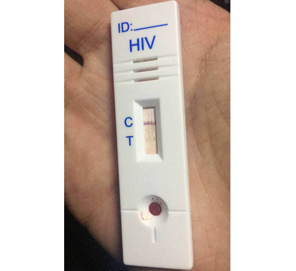 hiv试纸包埋线显色图片