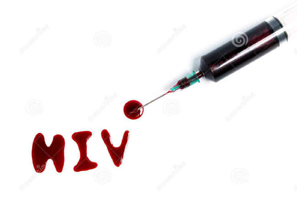 检测hiv