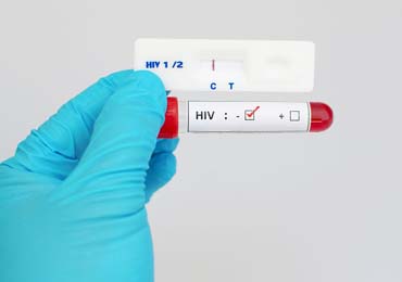 网上艾滋病试纸可靠吗